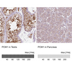 Anti-PCM1 Antibody