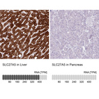 Anti-SLC27A5 Antibody