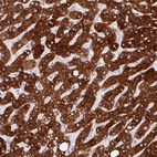 Anti-SLC27A5 Antibody