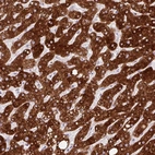 Immunohistochemical staining of human liver shows strong cytoplasmic positivity in hepatocytes.