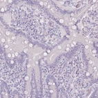 Immunohistochemical staining of human duodenum shows no positivity in glandular cells as expected.