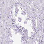 Immunohistochemical staining of human prostate shows no positivity in glandular cells as expected.