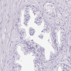 Anti-SLC27A5 Antibody