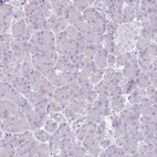 Anti-SLC27A5 Antibody