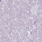 Immunohistochemical staining of human pancreas shows no positivity in exocrine glandular cells as expected.