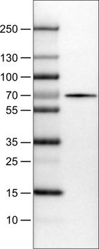 Lane 1: Marker [kDa]_br/_Lane 2: Human liver tissue lysate