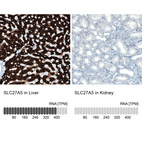 Anti-SLC27A5 Antibody