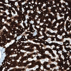 Immunohistochemical staining of human liver shows strong cytoplasmic positivity in hepatocytes.