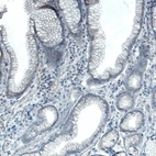 Immunohistochemical staining of human duodenum shows no positivity in glandular cells as expected.