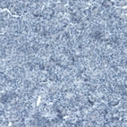 Immunohistochemical staining of human pancreas shows no positivity in exocrine glandular cells as expected.