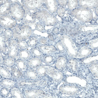Immunohistochemical staining of human kidney shows no positivity in cells in tubules as expected.