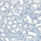 Immunohistochemical staining of human kidney shows no positivity in cells in tubules as expected.