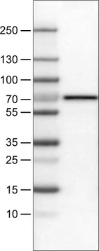Lane 1: Marker [kDa]_br/_Lane 2: Human liver tissue lysate
