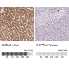 Anti-SLC27A5 Antibody