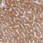 Anti-SLC27A5 Antibody