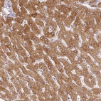 Immunohistochemical staining of human liver shows strong cytoplasmic positivity in hepatocytes.