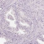 Immunohistochemical staining of human prostate shows no positivity in glandular cells as expected.
