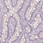 Anti-SLC27A5 Antibody