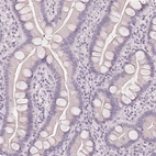 Immunohistochemical staining of human small intestine shows no positivity in glandular cells as expected.