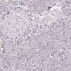 Anti-SLC27A5 Antibody