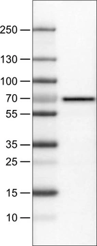Lane 1: Marker [kDa]_br/_Lane 2: Human liver tissue lysate