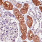 Anti-IDH1 Antibody