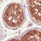 Immunohistochemical staining of human testis shows strong immunoreactivity in seminiferous tubules.