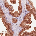 Immunohistochemical staining of human prostate shows strong positivity in glandular epithelium.