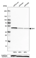 Western blot analysis in RT-4 cells transfected with control siRNA, target specific siRNA probe #1 and #2, using Anti-IDH1 antibody. Remaining relative intensity is presented. Loading control: Anti-PPIB.