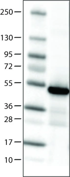 Lane 1: Marker [kDa]_br/_Lane 2: Human cell line RT-4