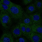 Anti-IDH1 Antibody