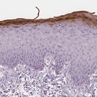 Immunohistochemical staining of human skin shows strong cytoplasmic positivity in squamous epithelial cells.