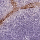 Immunohistochemical staining of human tonsil shows moderate to strong cytoplasmic positivity in squamous epithelial cells.
