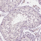 Immunohistochemical staining of human testis shows no positivity in cells in seminiferous ducts as expected.