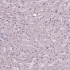Immunohistochemical staining of human liver shows no positivity in hepatocytes as expected.