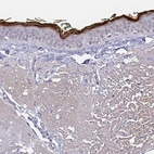 Immunohistochemical staining of human skin shows strong positivity in squamous epithelial cells.