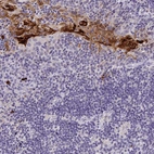 Immunohistochemical staining of human tonsil shows strong positivity in squamous epithelial cells.