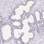 Anti-RNASE7 Antibody