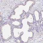 Immunohistochemical staining of human prostate shows no positivity in glandular cells as expected.