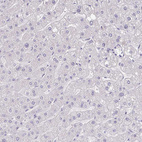 Anti-RNASE7 Antibody