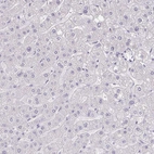 Immunohistochemical staining of human liver shows no positivity in hepatocytes as expected.