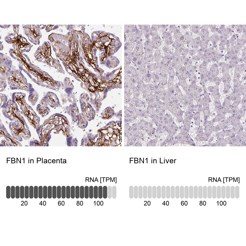 Anti-FBN1 Antibody