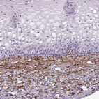 Immunohistochemical staining of human uterine cervix shows strong positivity in extracellular matrix.