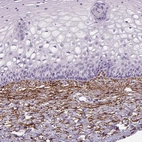 Immunohistochemical staining of human uterine cervix shows strong positivity in extracellular matrix.