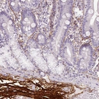 Immunohistochemical staining of human duodenum shows moderate to strong positivity in extracellular matrix.