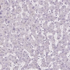 Immunohistochemical staining of human liver shows no positivity in hepatocytes as expected.