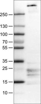 Lane 1: Marker [kDa]_br/_Lane 2: Human tonsil tissue lysate