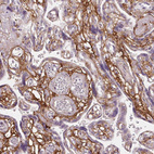 Anti-FBN1 Antibody