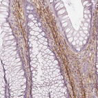 Anti-FBN1 Antibody