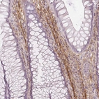 Immunohistochemical staining of human rectum shows strong positivity in the extracellular matrix.